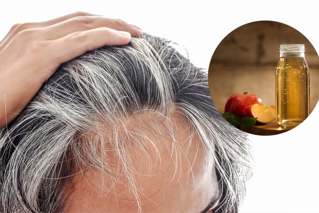 Discover the surprising benefits of apple cider vinegar for gray hair and how to use it effectively